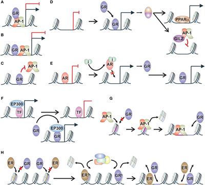 Glucocorticoid receptor action in prostate cancer: the role of transcription factor crosstalk
